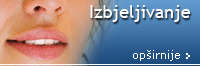 Izbjeljivanje